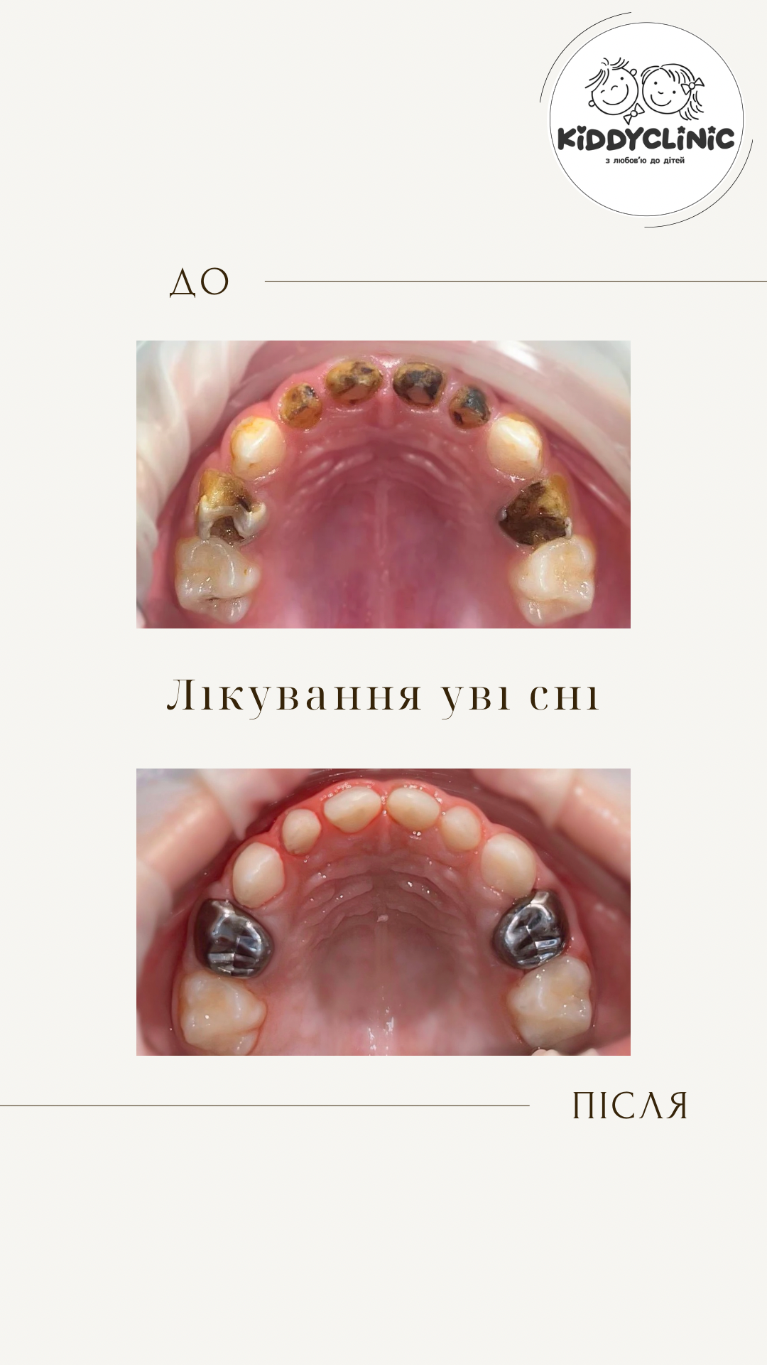 Лікування в седації
