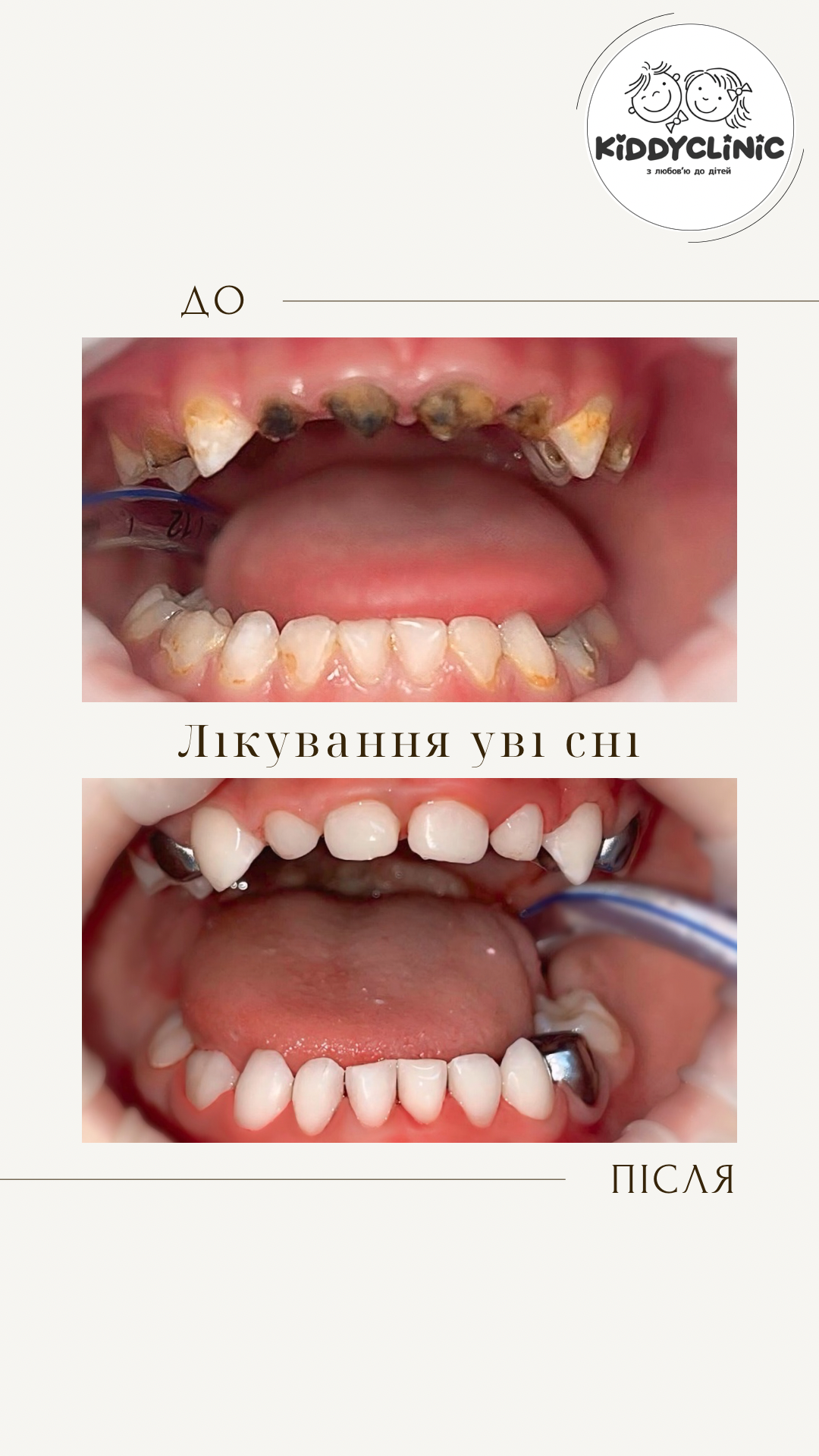 Лікування в седації