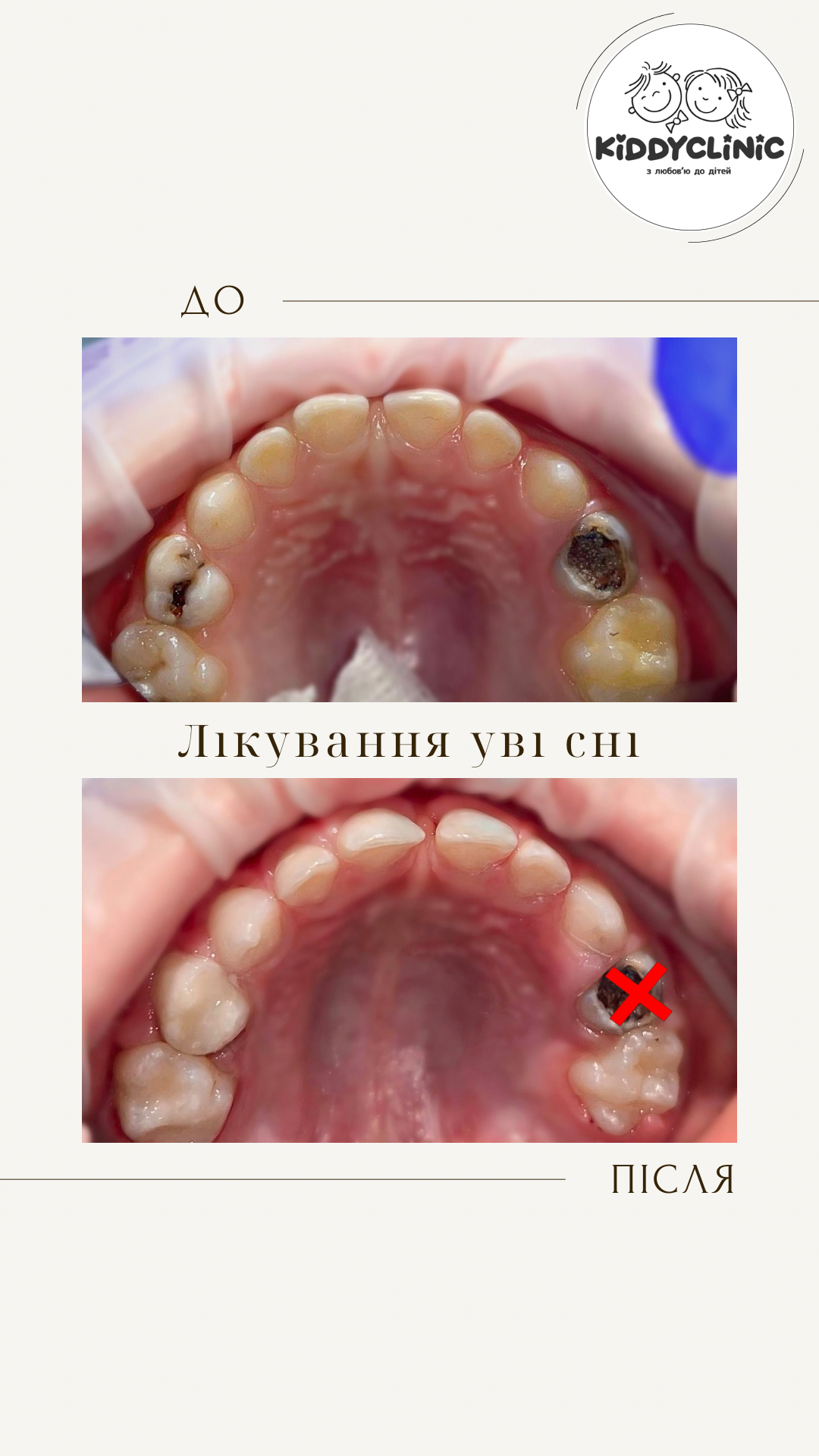Лікування в седації