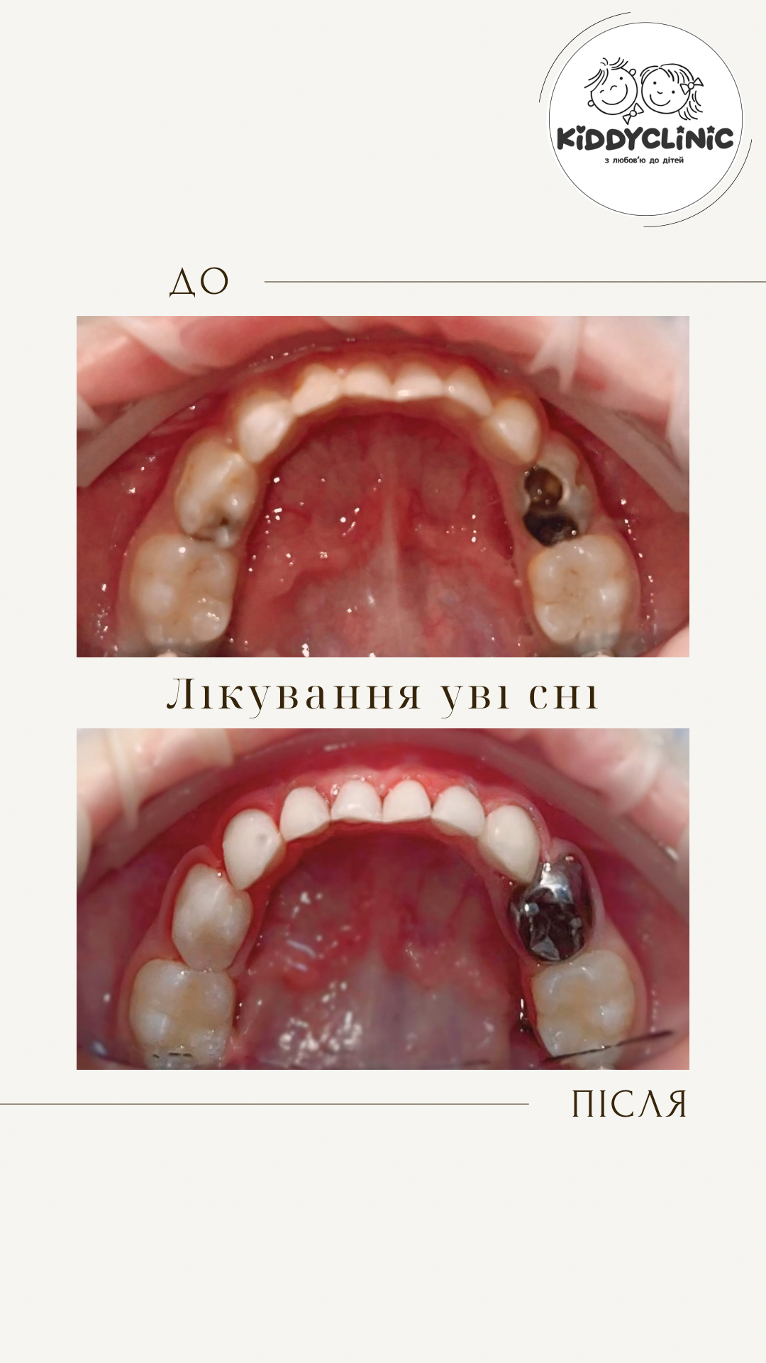 Лікування в седації
