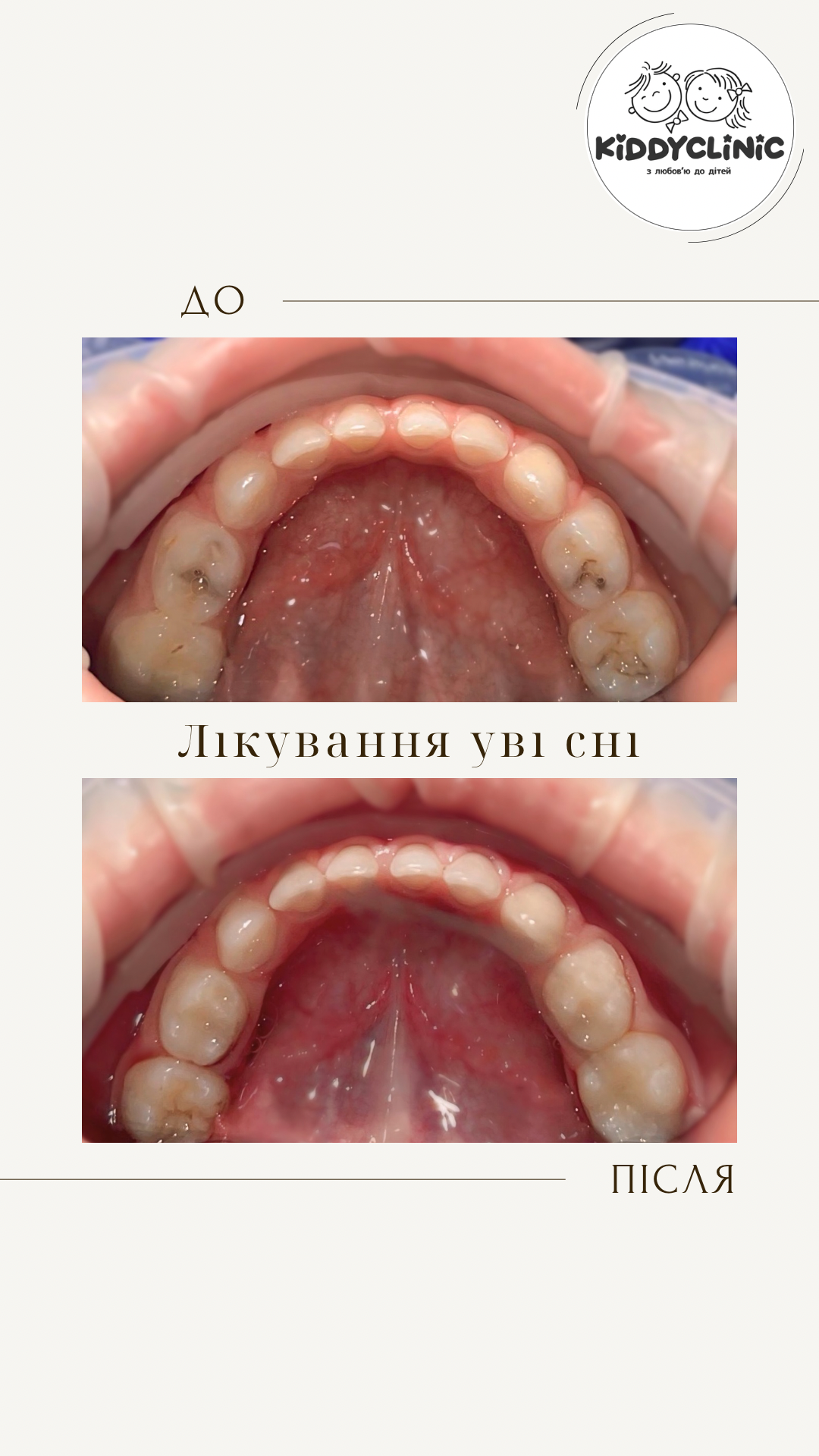 Лікування в седації